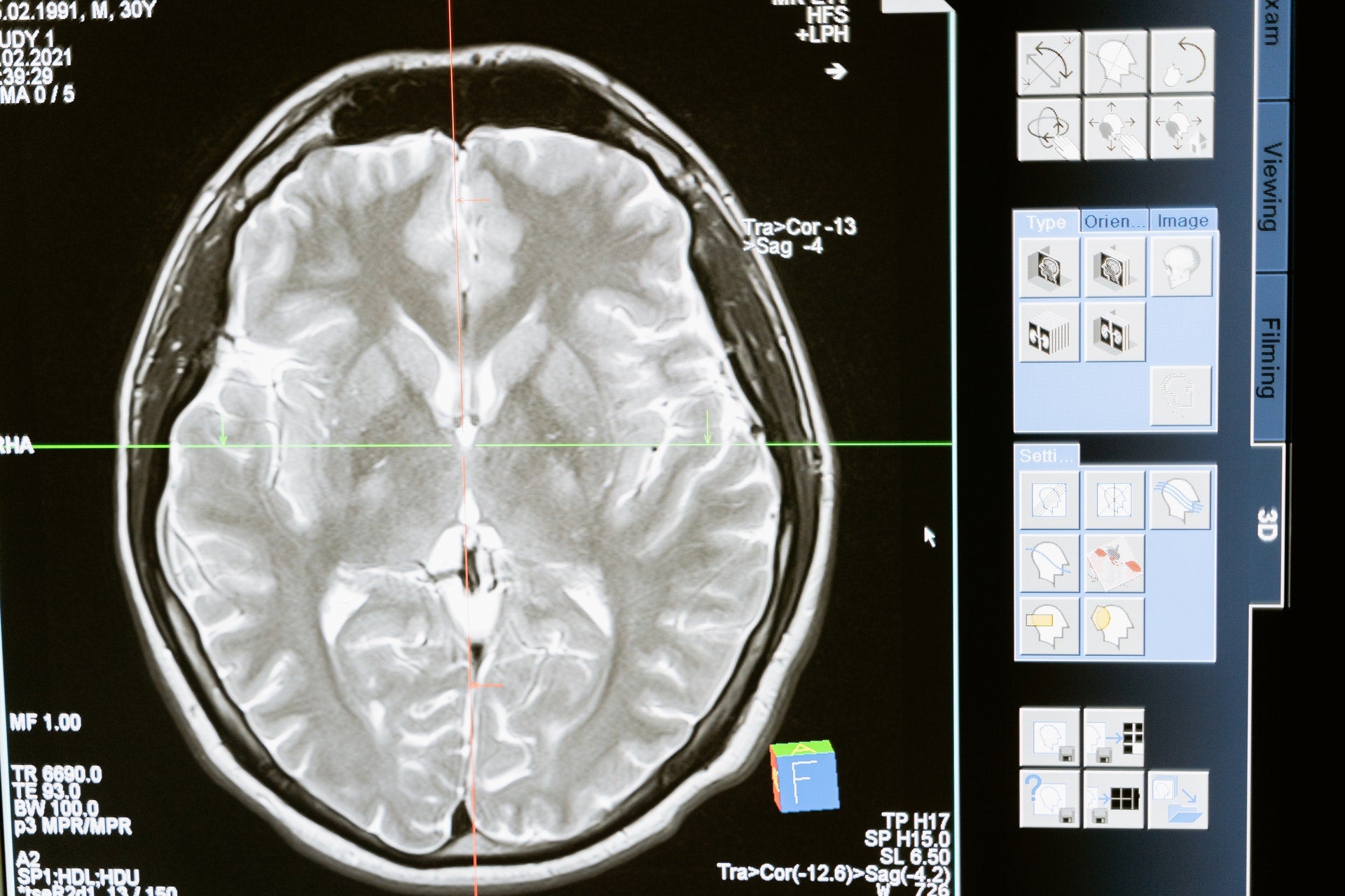 Do I Need A Dopamine Detox?